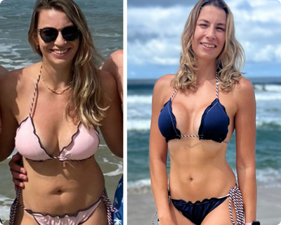 antes e depois - Fernanda - Programa EmagreSER